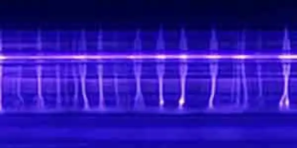 ozone plasma cell